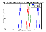 ICD9 Histogram Tuberculosis of lung infiltrative tubercle bacilli not found by bacteriological or histological exam