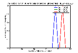ICD9 Histogram Tuberculosis of bladder unspecified