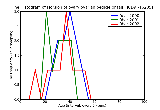 ICD9 Histogram Torsion of ovary ovarian pedicle or fallopian tube