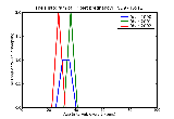 ICD9 Histogram Triplet pregnancy