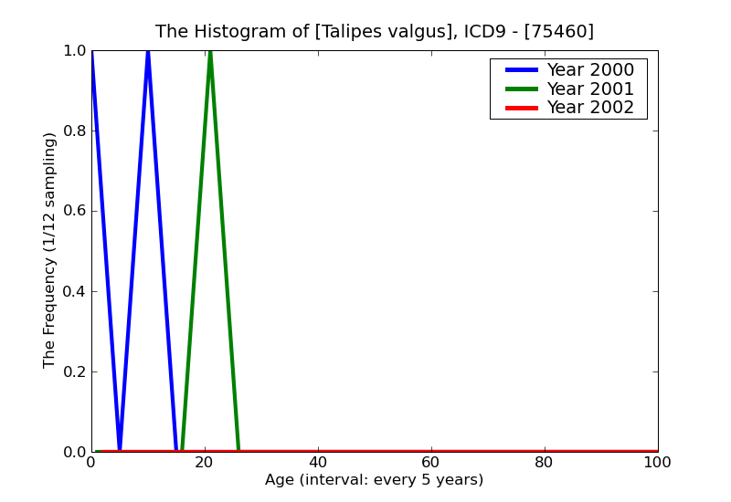 ICD9 Histogram Talipes valgus